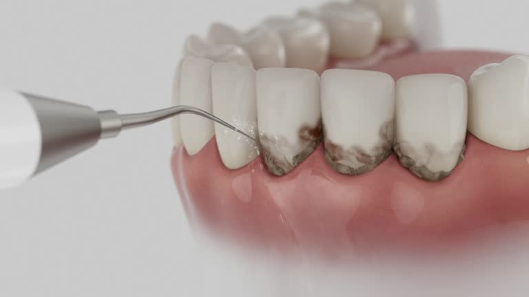 Reliable Dental contractor in Fort Atkinson, WI by Smile Center Dentistry